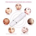 Limitless Skin Care Tool Shovel Face Pore Cleaner Ultrasonic Skin Scrubber Black Dot Acne Remove Facial Lifting Beauty Instrument (White)