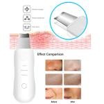 Limitless Skin Care Tool Shovel Face Pore Cleaner Ultrasonic Skin Scrubber Black Dot Acne Remove Facial Lifting Beauty Instrument (White)
