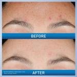 Cera VE Resurfacing Retino Serum 30ml 1oz