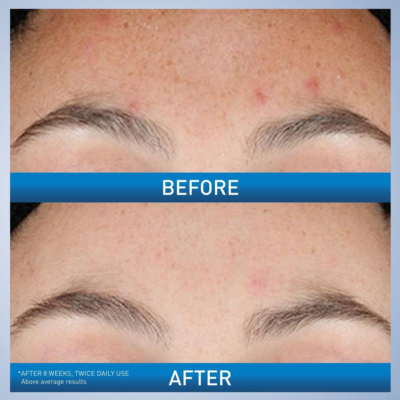 Cera VE Resurfacing Retino Serum 30ml 1oz