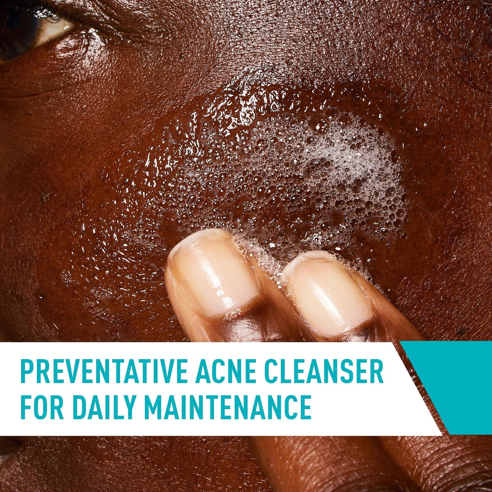 CeraVe Face Wash Acne Treatment Salicylic Acid Cleanser with Purifying Clay for Oily Skin Blackhead Remover and Clogged Pore Control 8 Ounce, multi, 8 Fl Oz, 237 ml